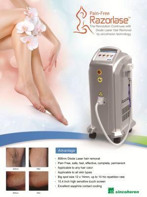 2019 New Style 3 Wavelength Diode Laser 755/808/1064nm Diode Laser Painless Hair Removal Machine