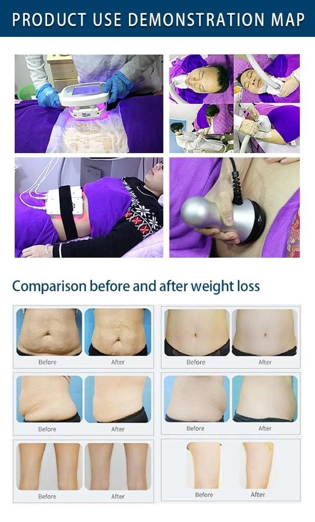 Lipolaser RF Cavitation Cryolipolysis Fast Slimming Machine