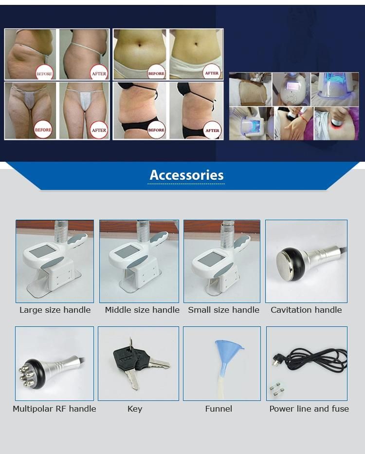 Hot Sale Cryo Fat Freezing Machine Cryolipolysis Slimming Machine