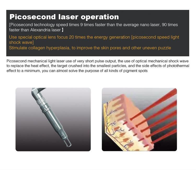 Tattoo Removal Picosecond Laser Machine for Sale