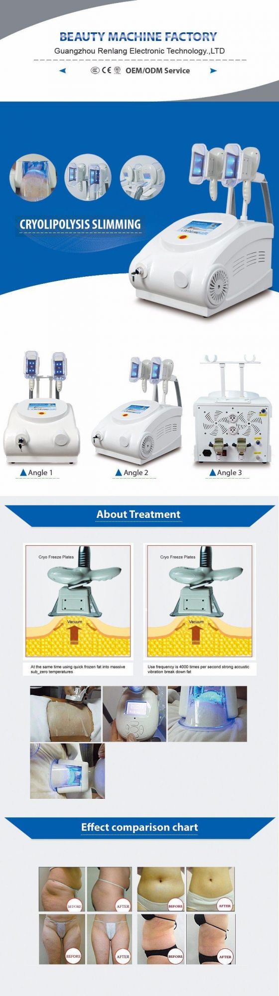 4 Cryo Handles Fat Freeze Cryotherapy Criolipolisis Cavitation Radio Frequency