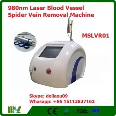 980nm Laser Blood Vessel Spider Vein Removal Machine Mslvr01A