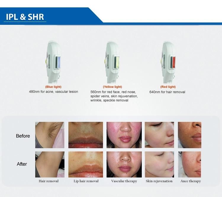 Portable IPL Shr Opt Skin Rejuvenation Hair Removal Machine