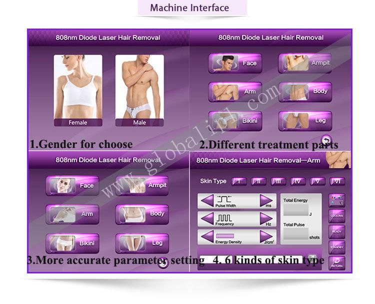 High Power Diode Laser Machines Epicare Hair Removal Alexandrite Laser