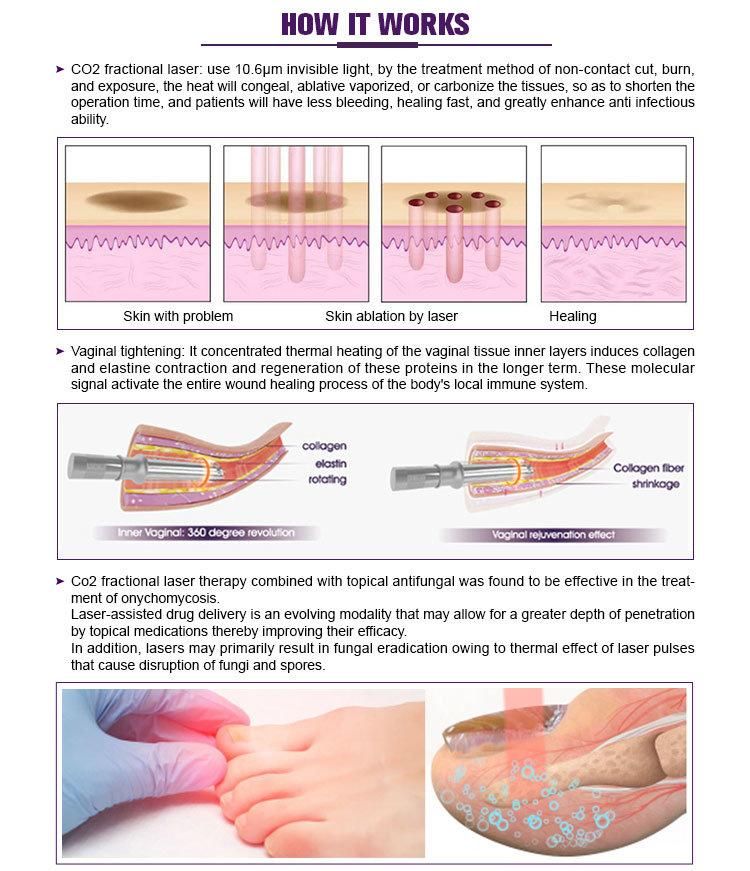 Globalipl Vertical CO2 Fractional Laser Wrinkle Removal Vaginal Tightening Machine