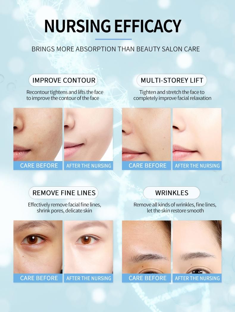 Newest 7D Hifu Vmax Anti-Wrinkle Machine for Face Lifting