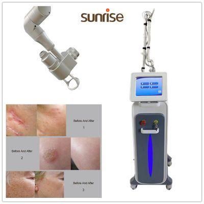 New Style CO2 Fractional Laser RF Metal Tube Skin Resurfacing Scar Removal Beauty CO2 Laser Vaginal Tightening Fractional Machine Laser CO2