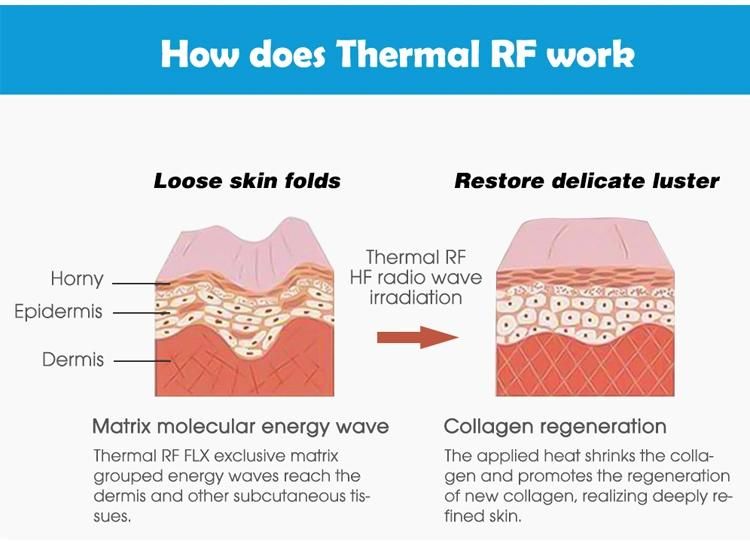 Beauty Salon Thermal RF Cavitation Skin Tightening Beauty Equipment