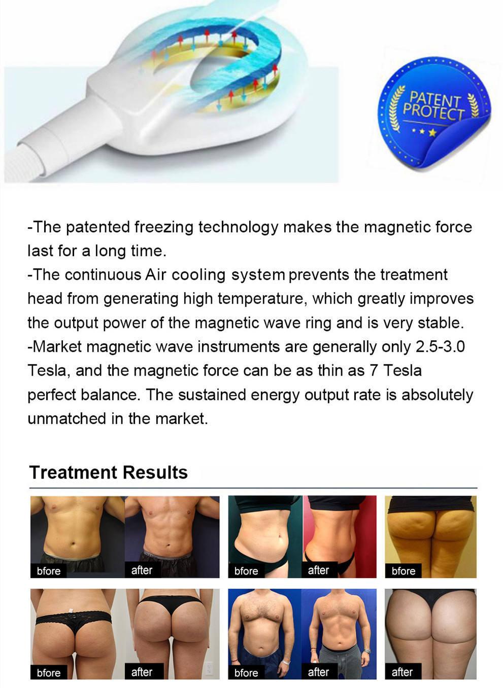 Body Shaping 5 Handles Emslim RF Electronic Muscle Stimulator Machine