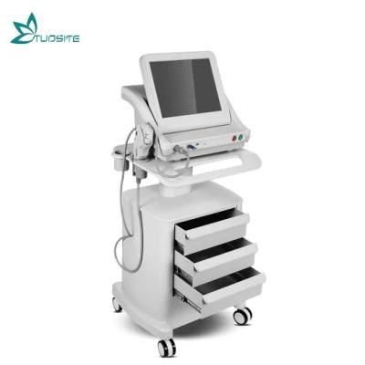Hifu Laser Machine for Remove Deep Wrinkles Around Mouth at Medical Aesthetic Center