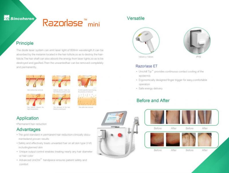 Sincoheren Laser Ice Hair Removal 808 Diode laser CE Provide Portable 808nm Permanent Hair Removal Machine Factory Lowest Price Professional Machine (T)