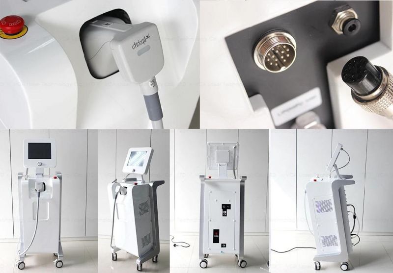 Beijing New Skin Lift Skin Tightening Wrinkle Removal Hifu Machine