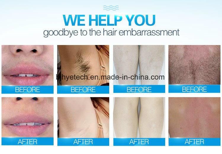 Professional Diode Laser 808nm Hair Removal Laser Skin Rejuvenation Beauty Equipment