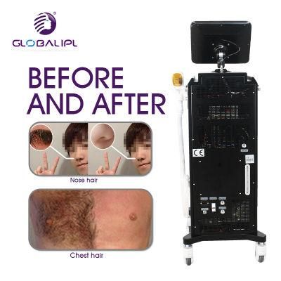 Globalipl Salon CE Approved Alexandrite Hair Removal Depiladora Laser 808nm