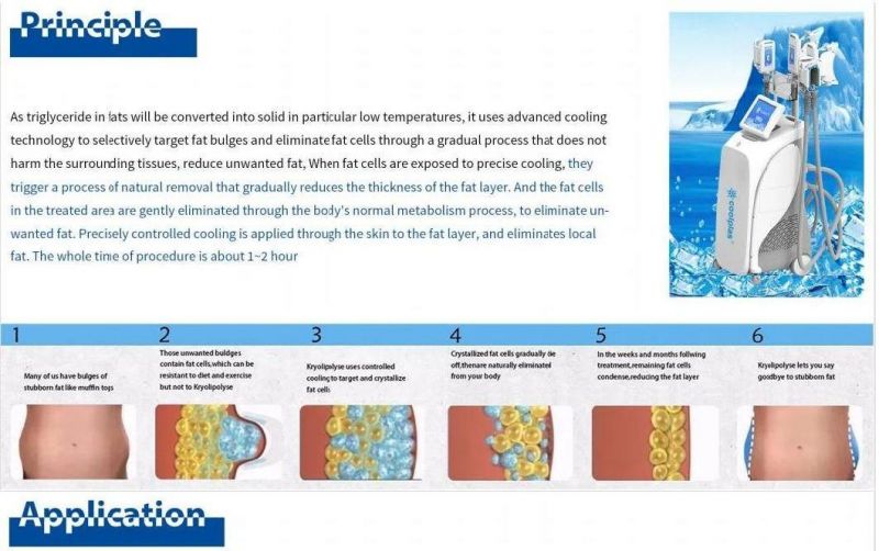 Coolplas New Improving Vacuum Equipment for Cellulite Removal Ice Cooling Cold Slimming Machine