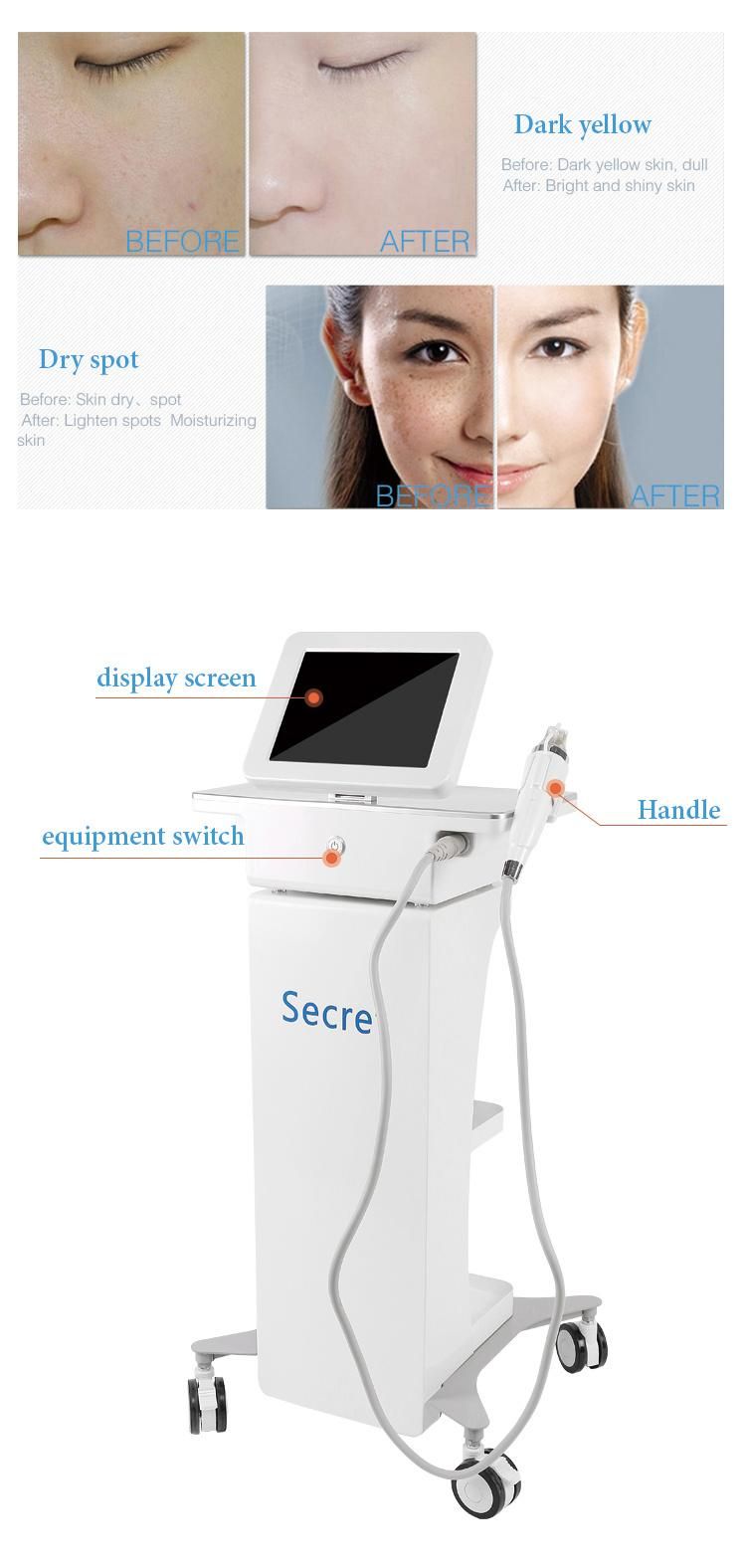 Portable Fractional Microneedle RF Machine for Acne Scars Stretchmarks Removal