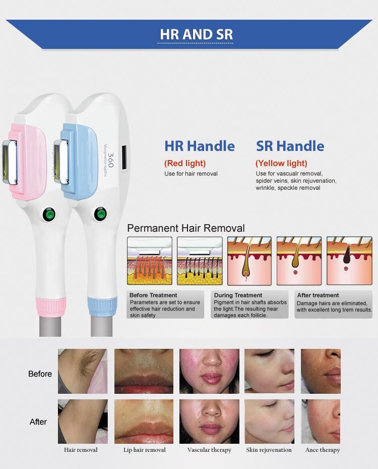 2 in 1 SSR Shr IPL Hair Removal Machine for Skin Rejuvenation
