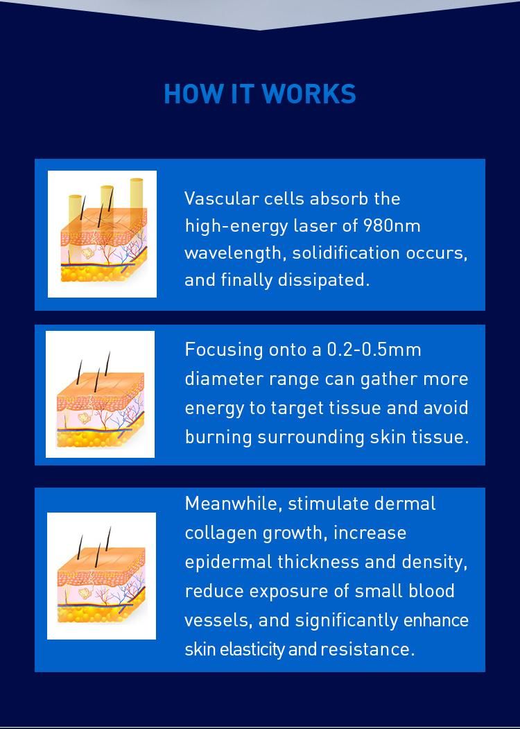 980nm Diode Laser Blood Vessal Removal 980nm Vascular Removal