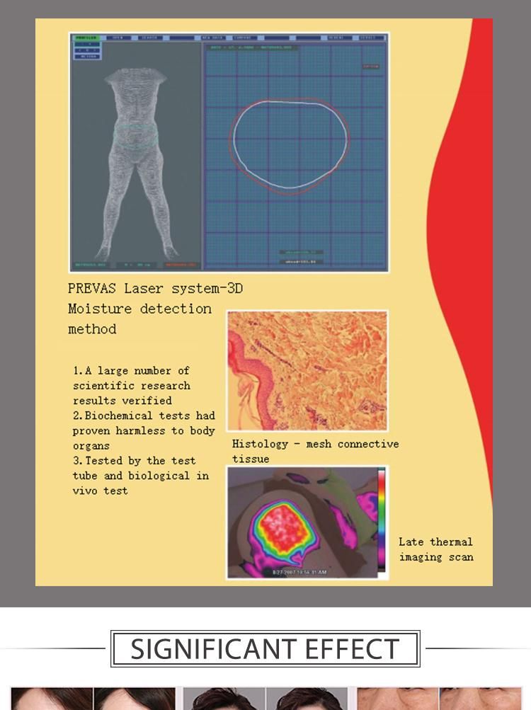 Medical Ce Approved Fat Removal Volume Reduction Body Shaping