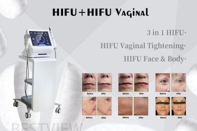 Hifu Machine Vaginal Tightening Machine Aesthetic Medical Equipment