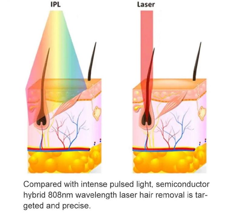 2022 New Arrival 100 Millions Factory Price Laser Least Painful 3 Wavelength 755nm 808nm 1064nm Diode Laser Hair Removal Machine Laser Hair Removal