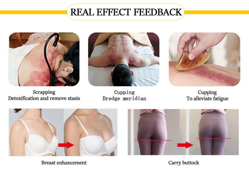 Heat-Resisting Cupping Vacuum Butt Enhancer Breast Enlargement Machine