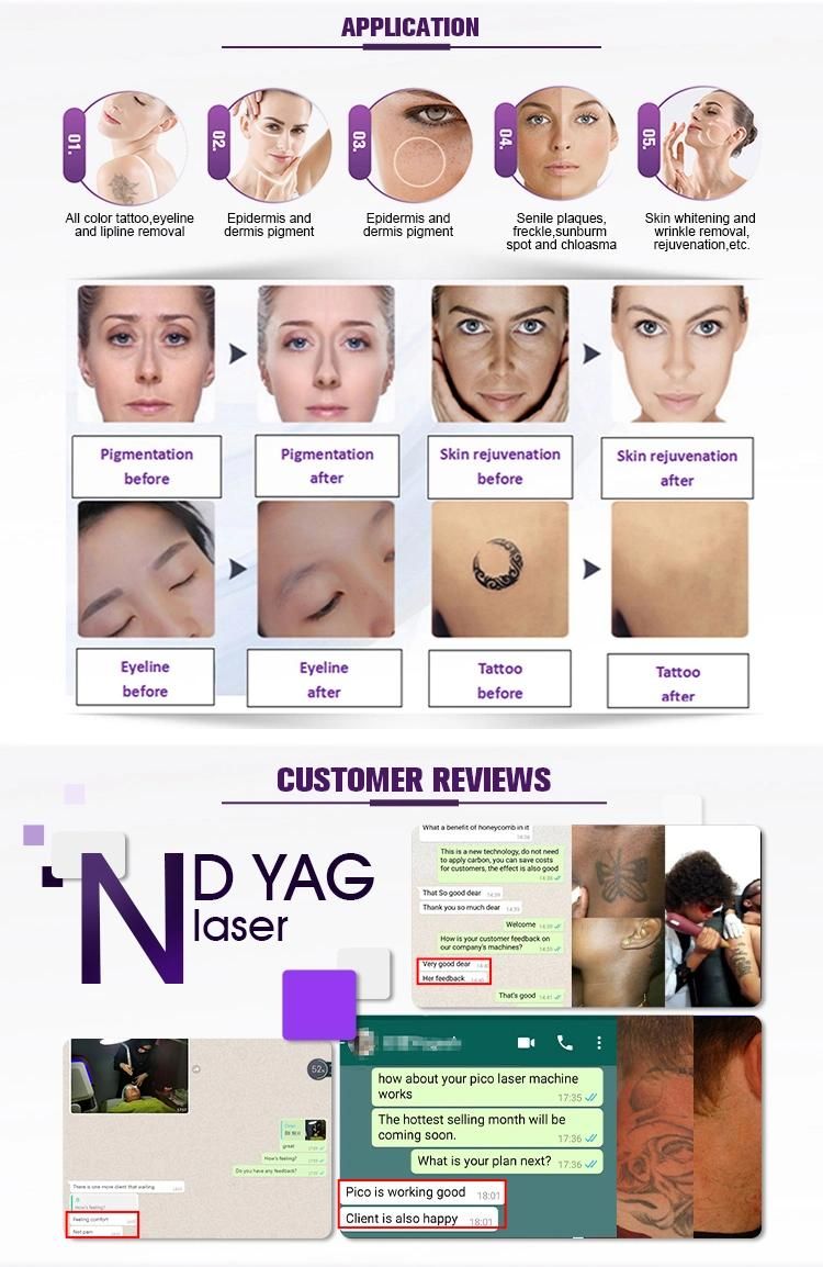 Laser Tattoo Removal 532 1064nm Pigment Therapy ND YAG Laser