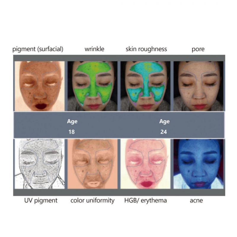 Facial Skin Analyzer Machine ADSS Grupo