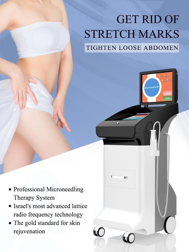 Fractional RF for Acne/Scar/Stretch Removal with 2MHz RF Beauty Machine