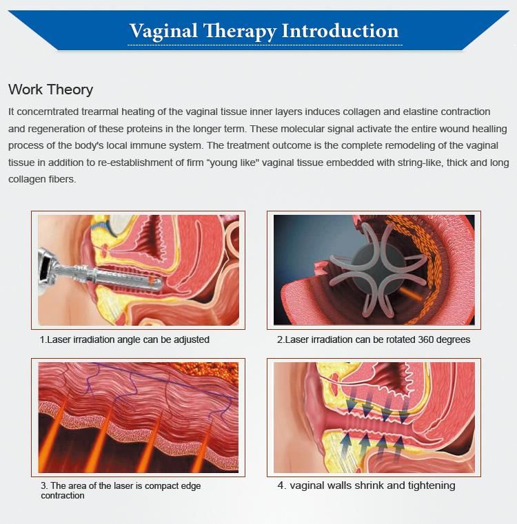 Portable Scar Removal Fractional CO2 Laser Vaginal Tightening Machine