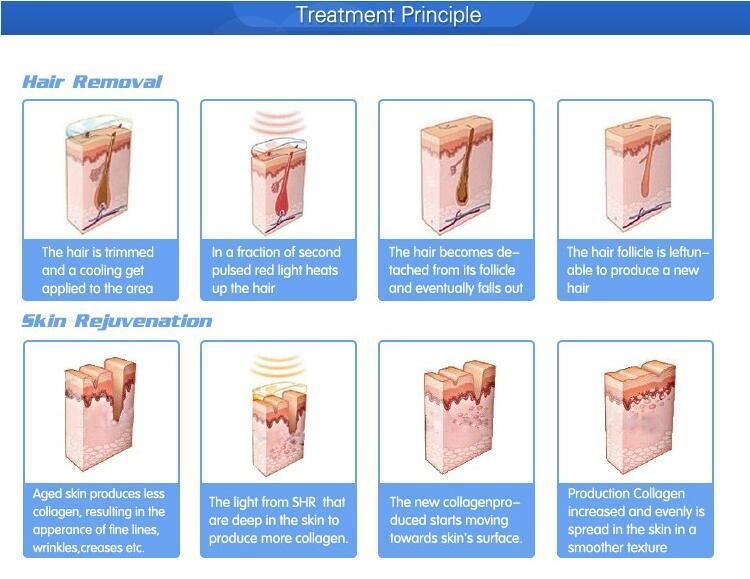 IPL Comprehensive Skincare Wrinkles Removal Beauty Machine