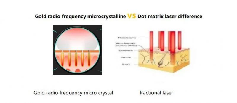 Beauty Equipment 4D Hifu +Microneedle RF Therapy Machine for Body Face