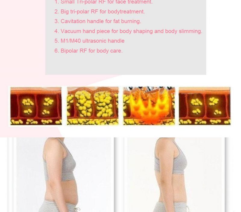 Ru+3 Ultrasonic RF Vacuum Cavitation Machine