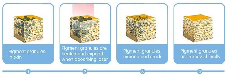 Picolaser Dark Spot Removing Tattoo Acne Removal Q Switched ND YAG Laser Picosecond Laser
