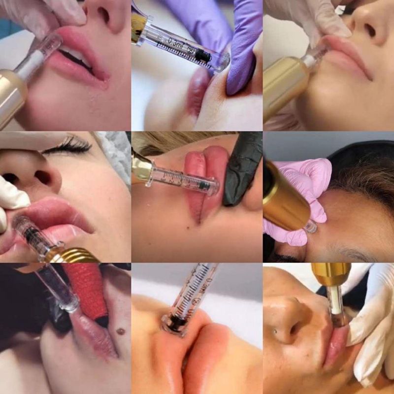 Hyaluronan Acid Meso Injector for Lip Lifting No Needle Dermal Filler