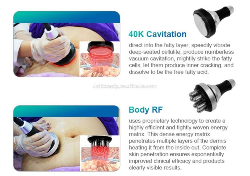 3 Cryo Handles RF Ultrasound Cavitation Cryolipolysis Weight Loss Cryotherapy Beauty Machine