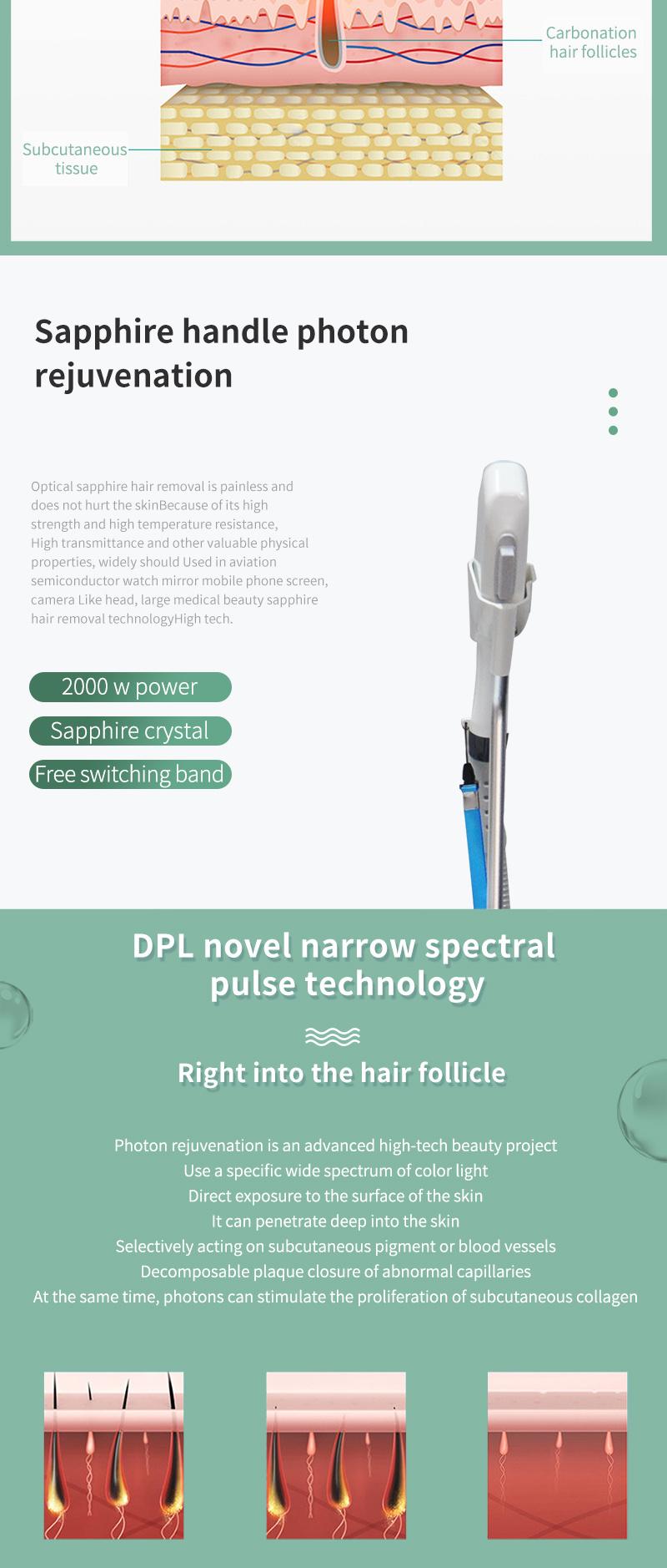 Europe and The United States Best-Selling Dpl Professional Photon Whitening Skin Rejuvenation Instrument / Hair Removal Instrument 2000 Watts High Power