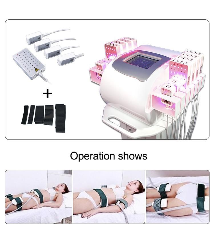Dual Wave Laser Lipolysis for Abdoments Slimming Machine with 336PCS Diodes