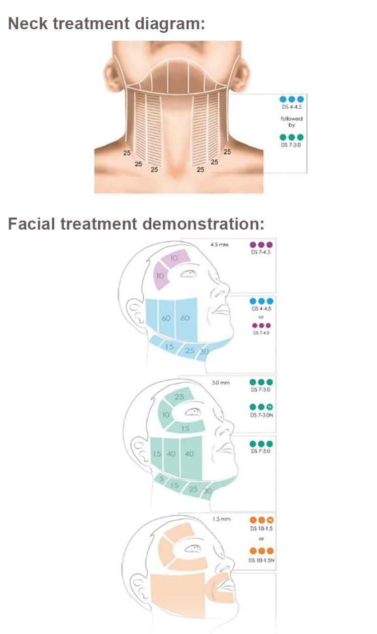 Skin Care Ultrasound Lifting Hifu Device with Hifu Cartridge Head