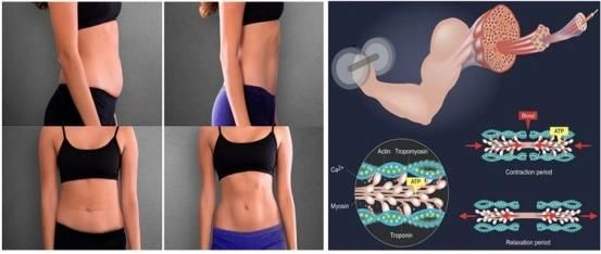 Portable Muscle Building EMS Non-Invasive Body Shaping Machine