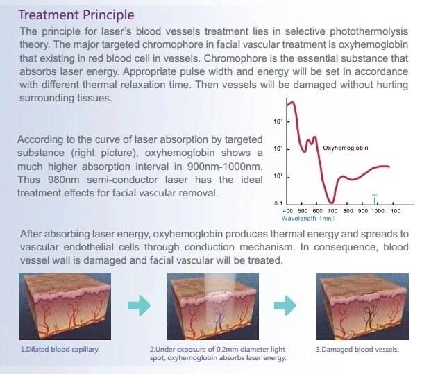 Body Leg Vein Viewer Vascular Finder / Facial Vein Removal Lesions Treatment