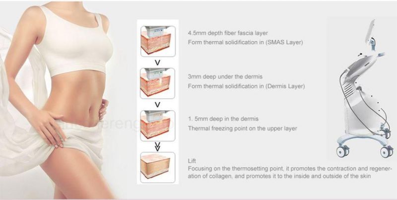 Ultraformer Hifu Smas Litinng Fractional RF Microneedle Machine, RF Fractional Ice Hifu Device for Anti Aging and Anti Wrinkle