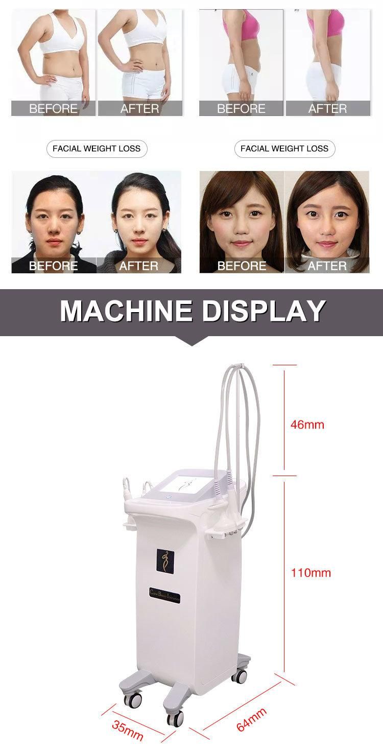 Skin Monopolar RF Body Weight Loss Slimming Machine Body Massage Cellulite Reduction Vacuum Massage Beauty Salon Equipment