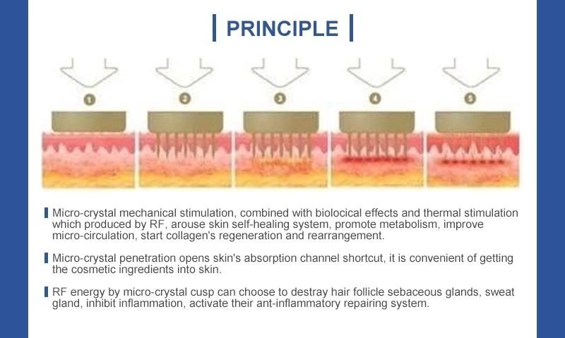 Newest Thermagic RF Fractional Microneedle for Acne Treatment Beauty Machine