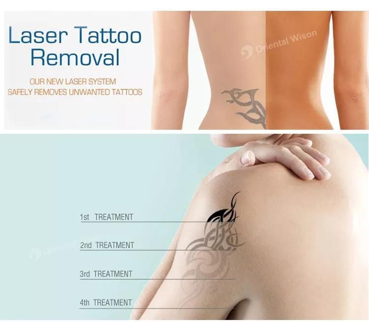 Pico Clinic 1064 532 755 Laser Equipment 300 Pico ND YAG Tattoo Machine for Skin Resurfacing and Pigmentation Removal