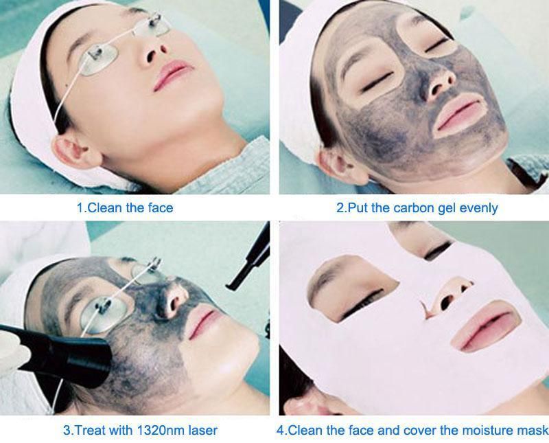 Beauty Equipment 532 Nm 1320nm 1064nm Long Pulse Blackhead Treatment Q Swiched ND YAG Laser