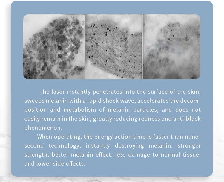 Medical CE Approved Tattoo Birthmark Removal Q Switch 1064nm 532nm Picosecond ND YAG 755 Picosecond Pulse