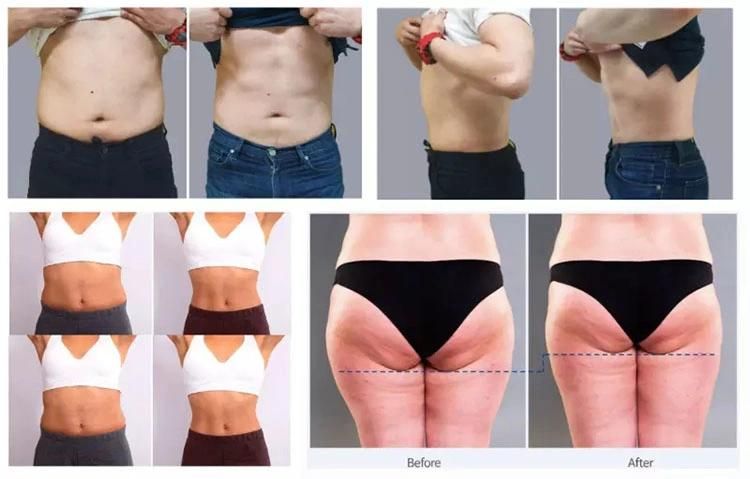 EMS Muscle Stimulator Body Contouring Teslaslim Emshaping Circslim Teslasculpt Hi EMS Emts Emslimming Sculpture Neo