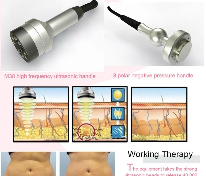 Ru+5 Ultrasonic Liposuction Cavitation Slimming Machine for Weight Loss