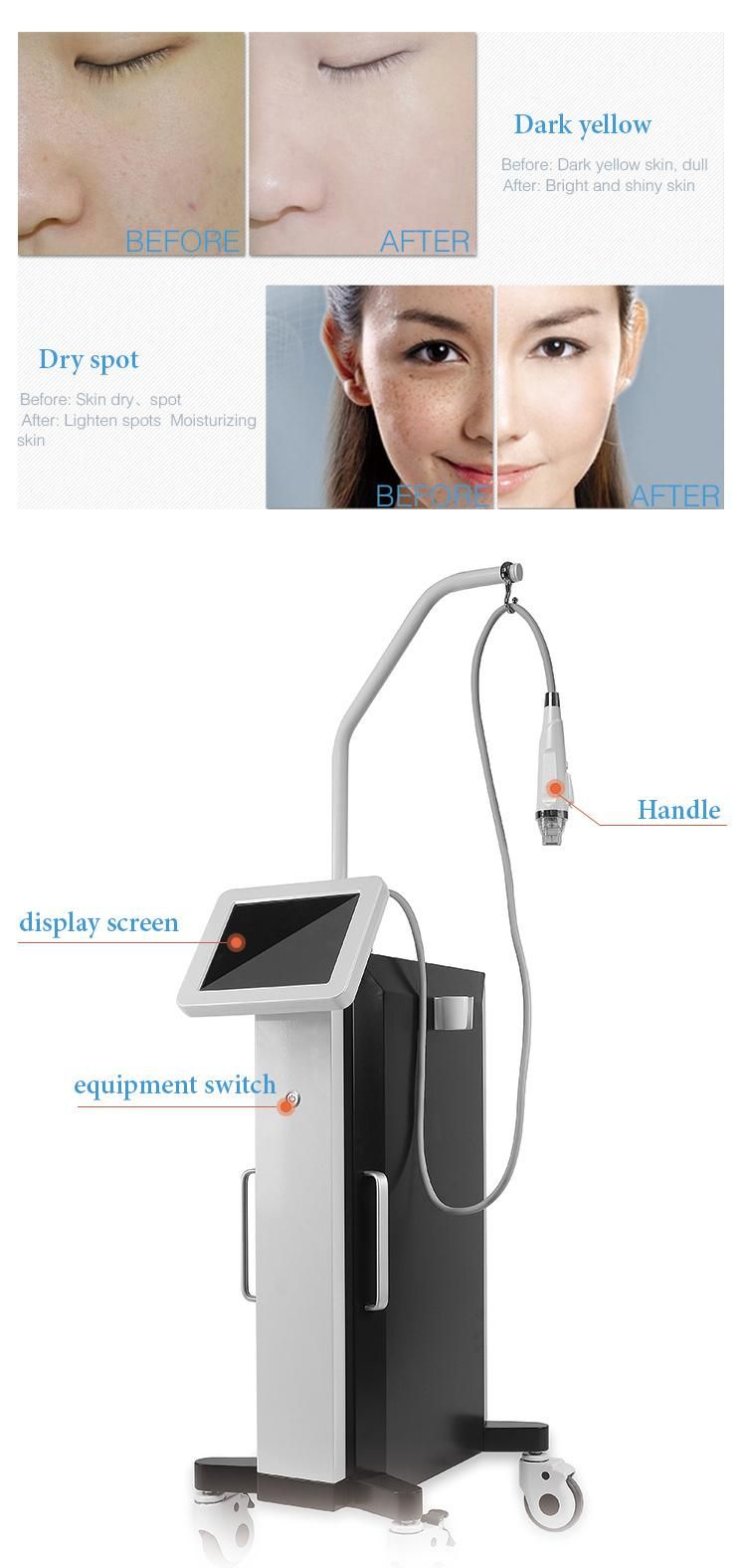 High-Class RF Face Care Microcrystalline Spot Removal Microneedle Beauty Machine